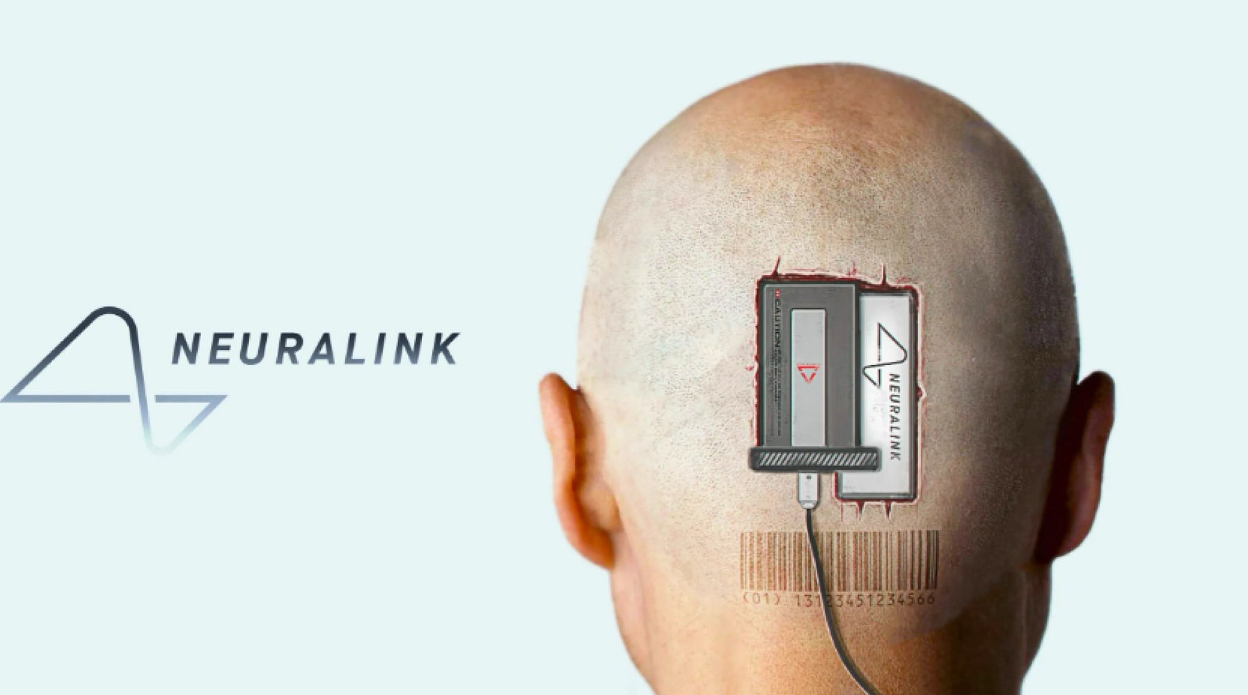 Вы сейчас просматриваете Нейролинк: как работает имплантат Илона Маска